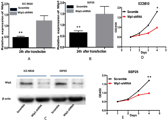 Transfection of Wip1-shRNA represses proliferation of ICC-9810 and SSP25 cells in vitro.