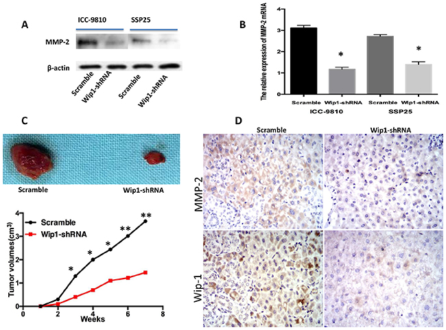 Transfection of Wip1-shRNA impaired ICC-9810 and SSP25 cell tumor formation through MMP-2 in vivo.