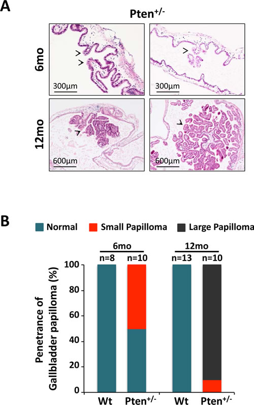 Haploinsufficient tumor suppressive function of