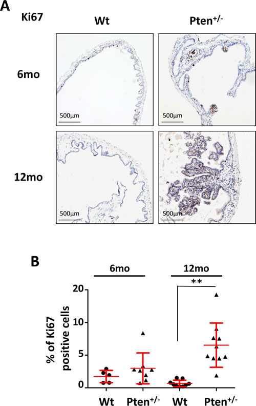 High frequency of Ki67 positive cells in