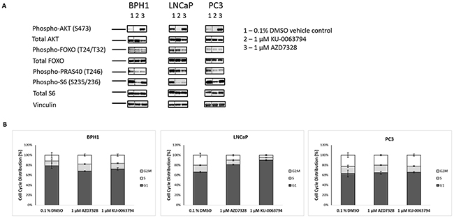 Inhibition of AKT and mTOR kinase reduces phospho-biomarker expression and induces cell cycle arrest in LNCaP cells.