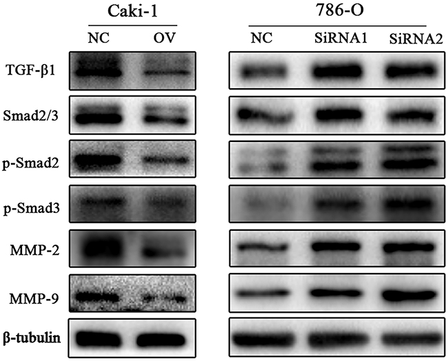 CD82 suppresses the TGF-&#x03B2;1/Smad/MMP pathway.