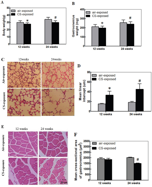 Cigarette smoking induces the lung injury and skeletal muscle atrophy in mice.
