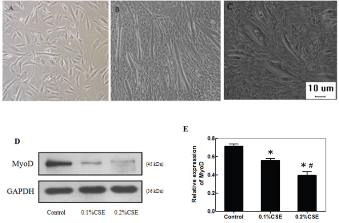 CSE reduces the myotube formation and MyoD expression during the differentiation of C2C12 cells.