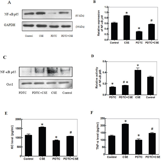CSE enhances the NF-&#x03BA;Bp65 activation and inflammatory cytokine production in differentiating C2C12 cells.