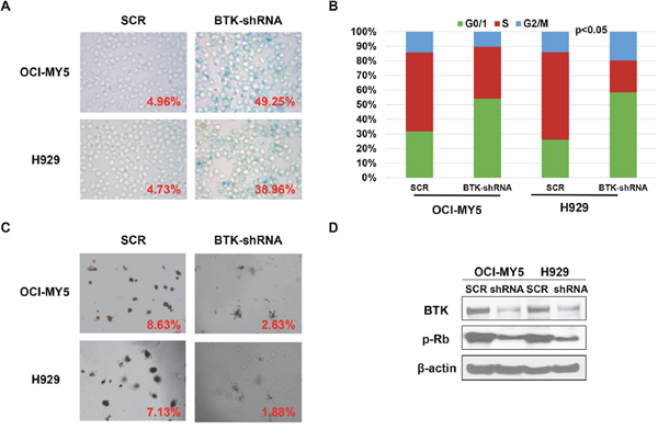 Depletion of BTK in MM cells induces myeloma cellular senescence.