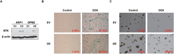 Increased BTK expression suppresses doxorubicin-induced cellular senescence in MM cells.