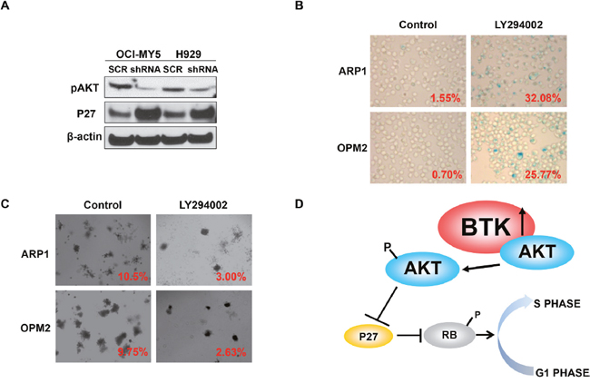 BTK activates AKT and blocks RB activity in MM cells.