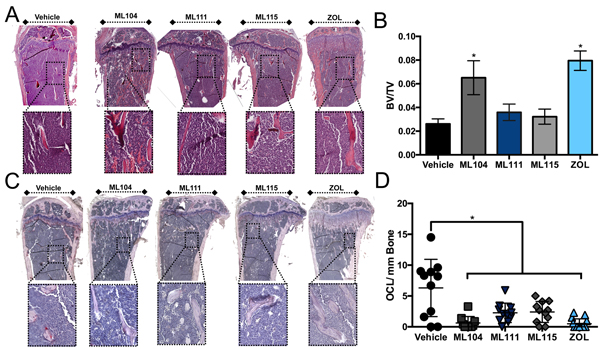 The BMMPI, ML104, protects against 5TGM1 induced bone loss.