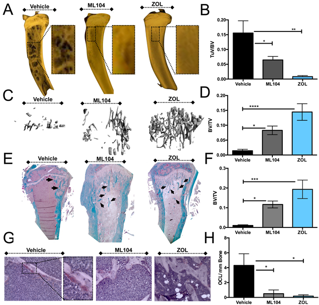 The BMMPI, ML104, protects against U266 induced bone loss.