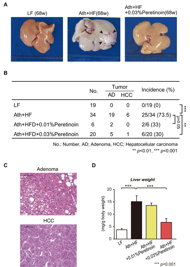 Effects of peretinoin on liver tumorigenesis in mice fed the Ath+HF diet.