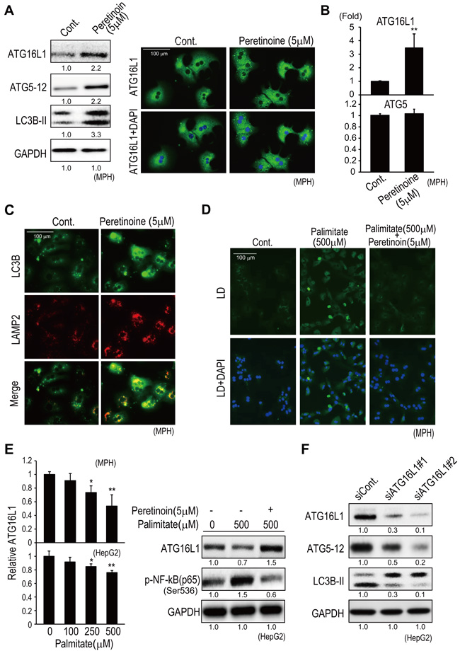 Peretinoin increases Atg16L1 expression and activates autophagy in MPH.