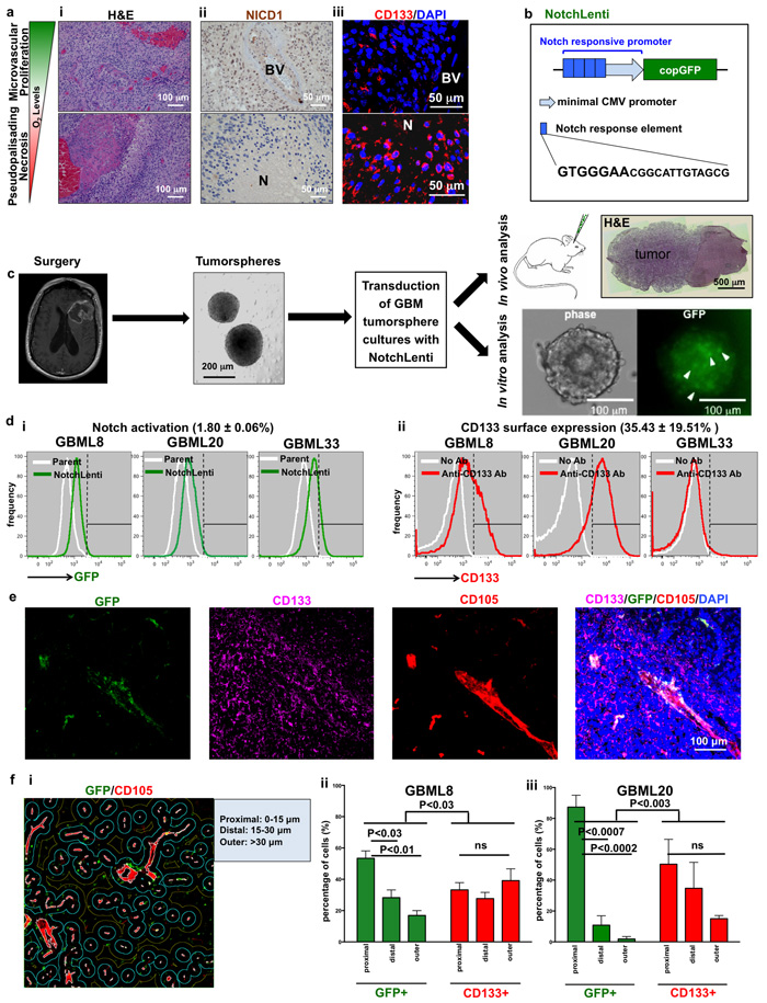 Notch activation and CD133 cell surface expression show differential intratumoral localization in human GBM.