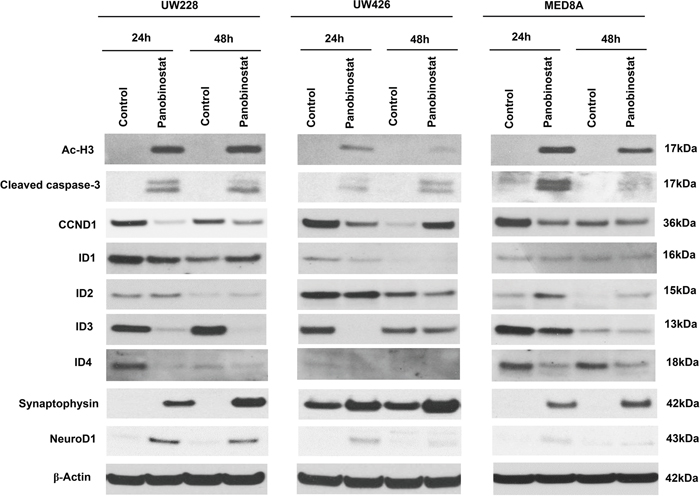 Effect of panobinostat on histone acetylation, apoptosis, cell cycle, IDs and differentiation-related signal pathway in medulloblastoma cells.