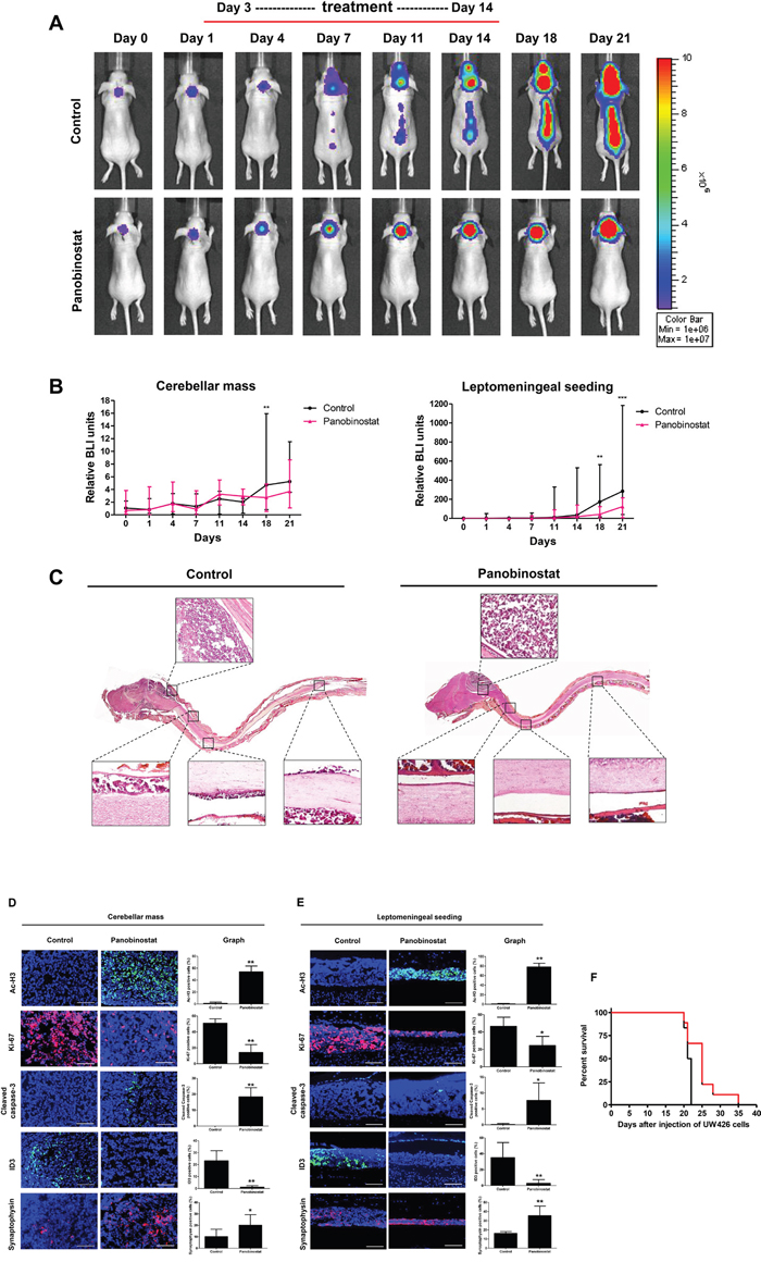 Therapeutic effect of panobinostat in a UW426-effLuc medulloblastoma leptomeningeal seeding model.