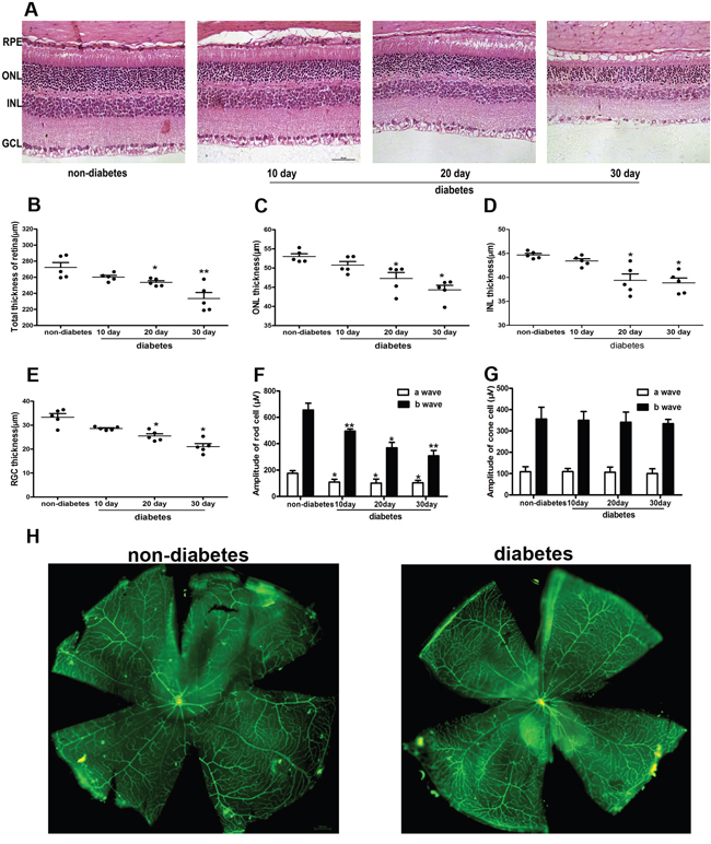 Morphological analysis of neuronal cells and vessels in the retina of diabetic mice.