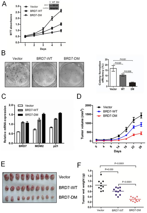 Fig 4: The degradation of BRD7 by APC/C E3 ligase plays key roles in cell growth and the tumorigenesis of osteosarcoma.