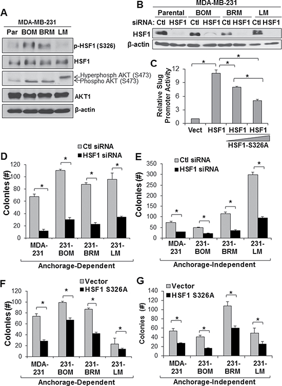 Loss of HSF1 activity reduces growth of metastatic breast cancer cells.