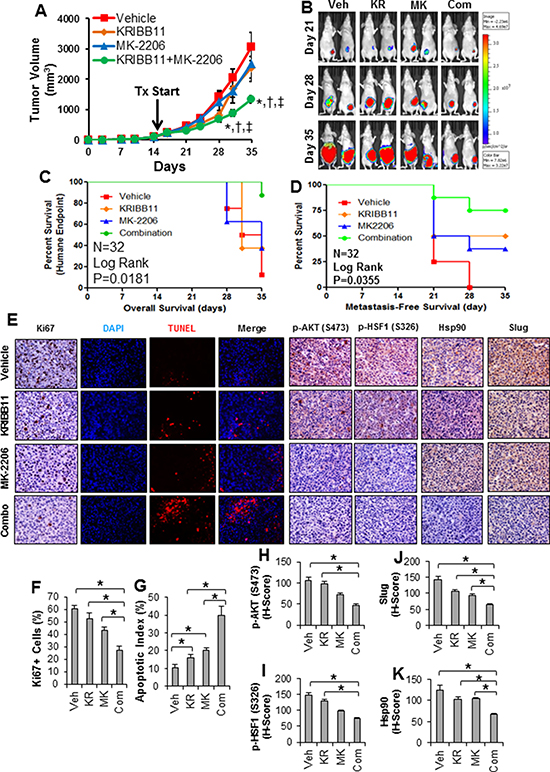 Combination of HSF1 and AKT inhibition reduces growth and metastasis of triple-negative breast cancer in vivo.