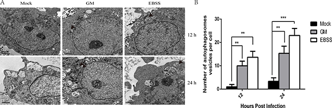 Autophagosome formation in Newcastle disease virus (NDV) chick embryo fibroblast (CEF) cells.