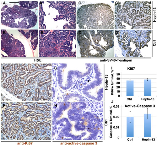 Primary prostate tumors in HepIn-13-treated (0.25%) and control LPB-Tag/PB-Hepsin mice.