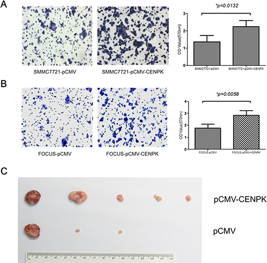 The effect of CENP-K overexpression on HCC cell migration and tumorigenicity.