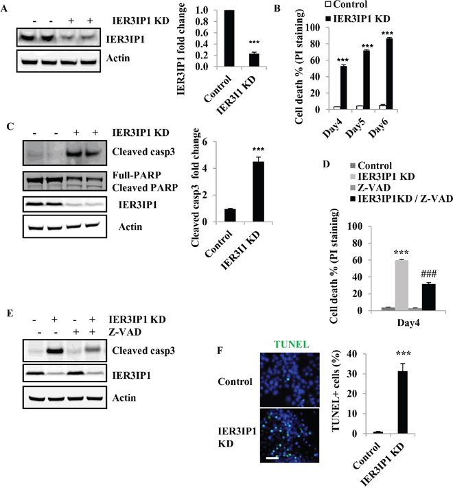 Reduced IER3IP1 expression leads to apoptosis in MIN6 cells.