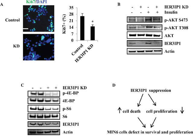 IER3IP1 suppression decreases MIN6 cells proliferation.