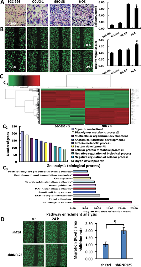 Identification of RNF125 as a positive metastasis-related gene in vitro.