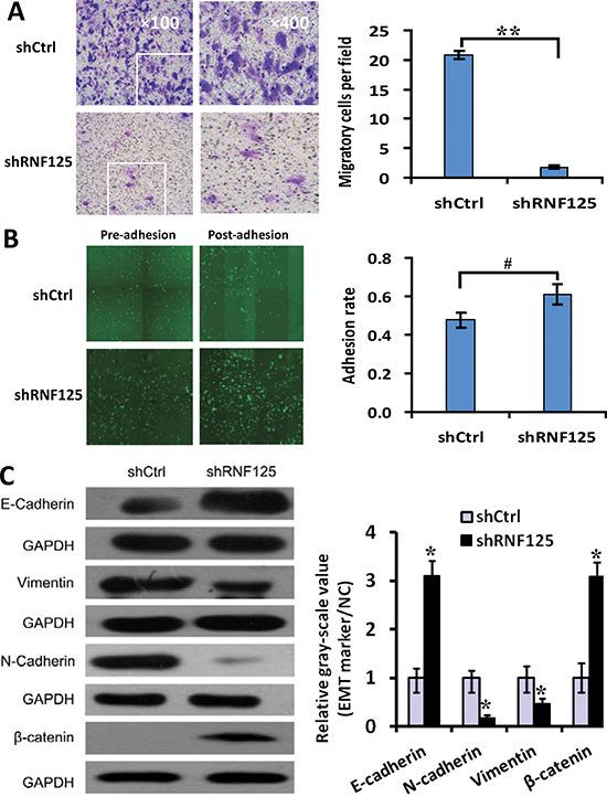 The influence of RNF125 knockdown on the invasion, adhesion and EMT of GBC NOZ cells.