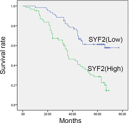 Kaplan-Meier survival analysis for high SYF2 expression versus low SYF2 expression in 123 patients of BC.
