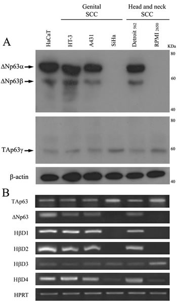 Expression of the p63 isoforms and H&#x3b2;Ds in human normal keratinocytes and SCC cell lines.