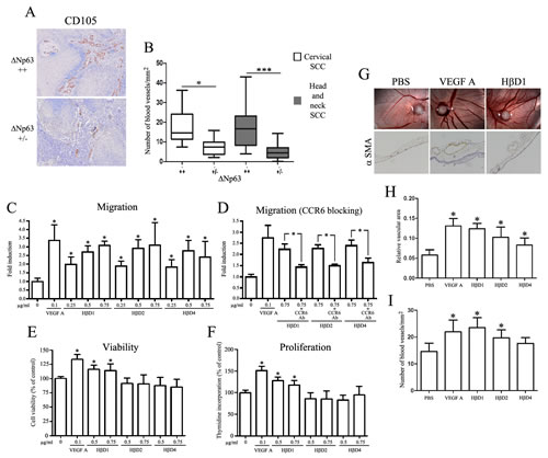 &#x394;Np63-regulated H&#x3b2;Ds enhance endothelial cell migration.