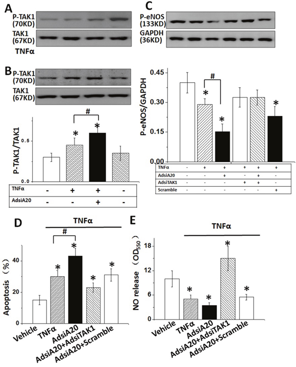 TAK1 inactivation was required for TNF&#x03B1;-induced p-eNOS expression.