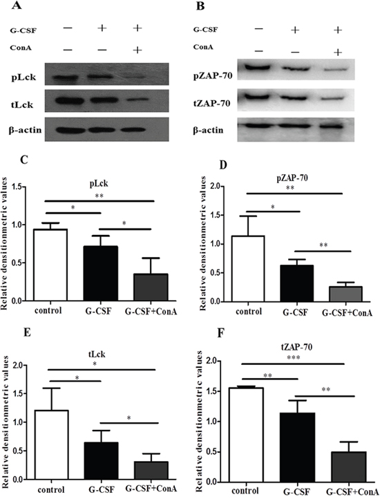 G-CSF stimulation suppressed the expression of Lck and ZAP-70 in vitro.