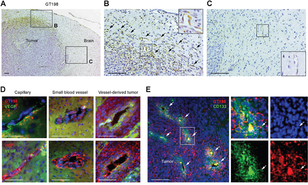 GT198+ pericytes give rise to tumor cells in U-251 glioblastoma xenografts.