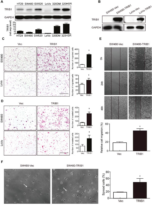TRIB1 promotes motility and spreading of CRC cells.