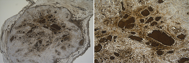 In vivo CD70 protein analysis in hypoxic regions.