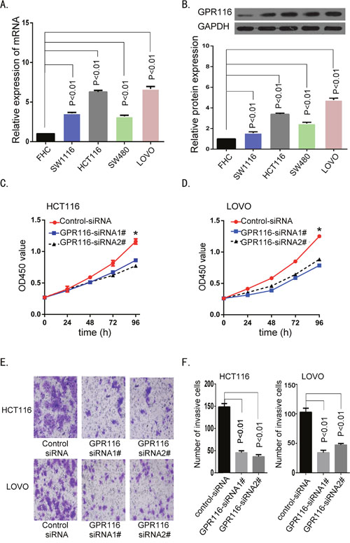 Downregulation of GPR116 inhibited colon cancer cell proliferation and invasion.