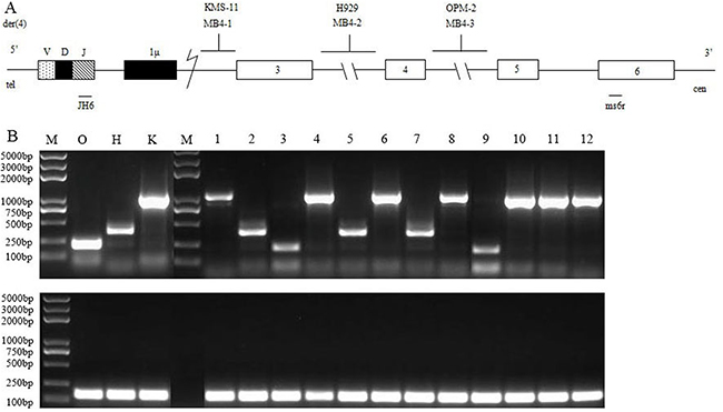 RT-PCR assay of detecting IGH/MMSET hybrid transcripts associated with the t(4;14)(p16.3;q32) translocation in MM.