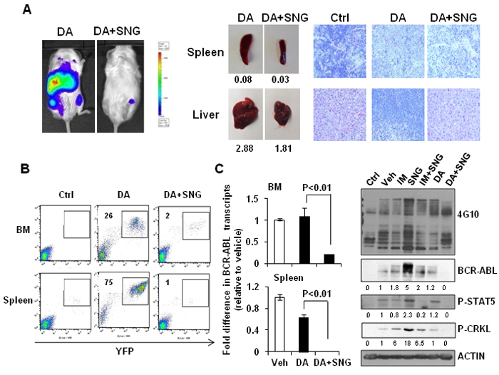 Combination treatment of SNG1153 with DA significantly reduced leukemic cell infiltration in mouse hematopoietic tissues.