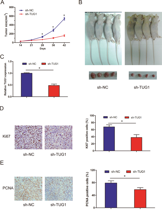 Effect of lncRNA TUG1 on cervical cancer cell growth in vivo.