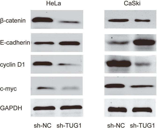 Effect of lncRNA TUG1 on Wnt/&#x03B2;-catenin signaling pathway in cervical cancer cells.