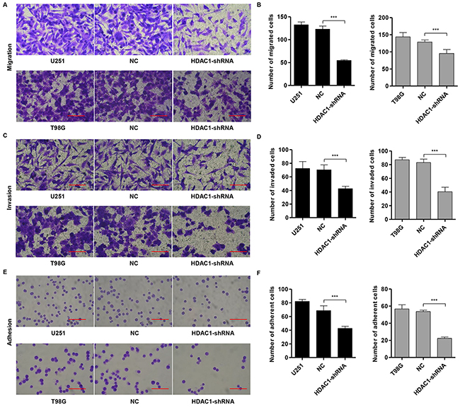 Knockdown of HDAC1 inhibits migration, invasion and adhesion in glioma cell lines.