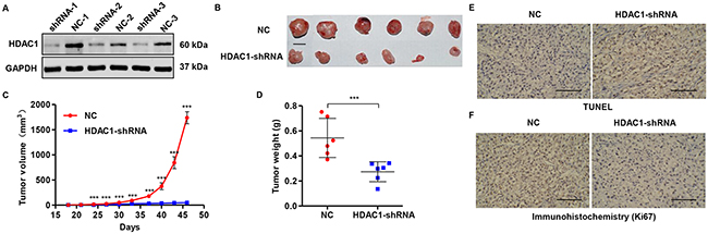 Knockdown of HDAC1 in glioma cells reduces tumor growth in vivo.