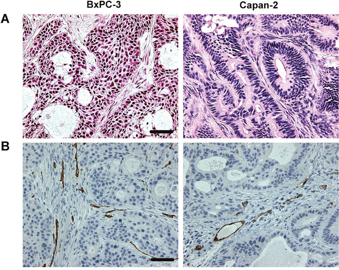Histological appearance of BxPC-3 and Capan-2 PDAC xenografts.