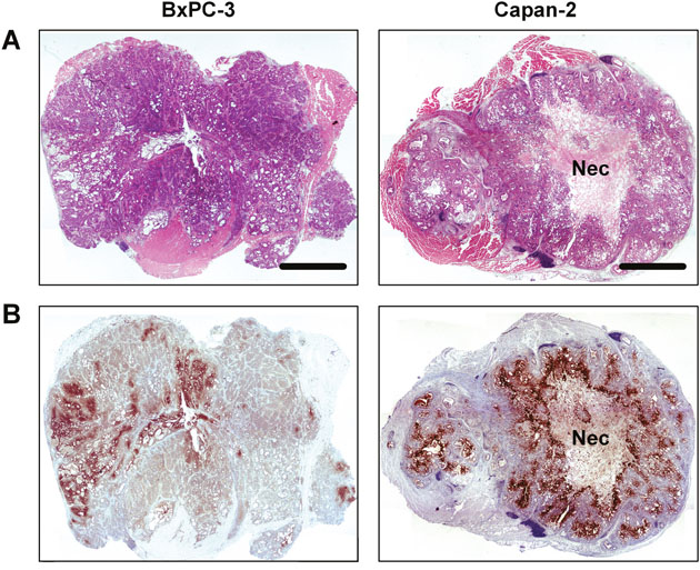 Whole mount histological preparations of BxPC-3 and Capan-2 PDAC xenografts.