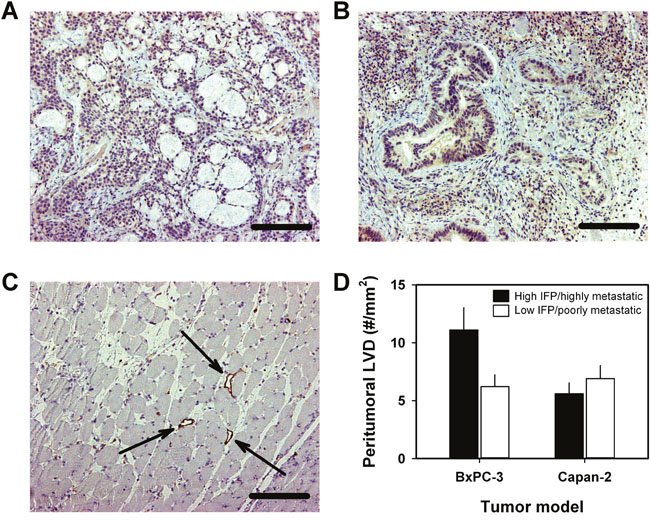 Lymphatics associated with BxPC-3 and Capan-2 PDAC xenografts.