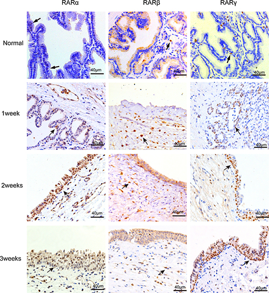 IHC staining of RARs on normal canine prostate and the wound area after TmLRP.