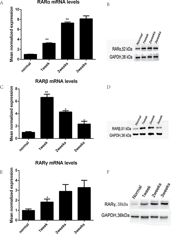 The expression of RARs was increased after TmLRP analyzed with western blotting and real-time qPCR.